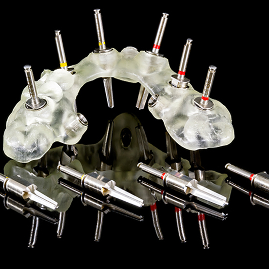 무절개 임플란트